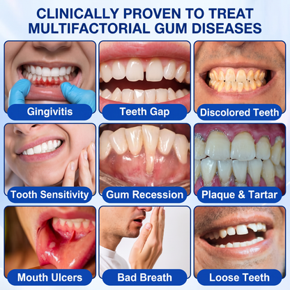 🇨🇦Pureluxo® 🦷GumRevive periodontal repair gel🌿