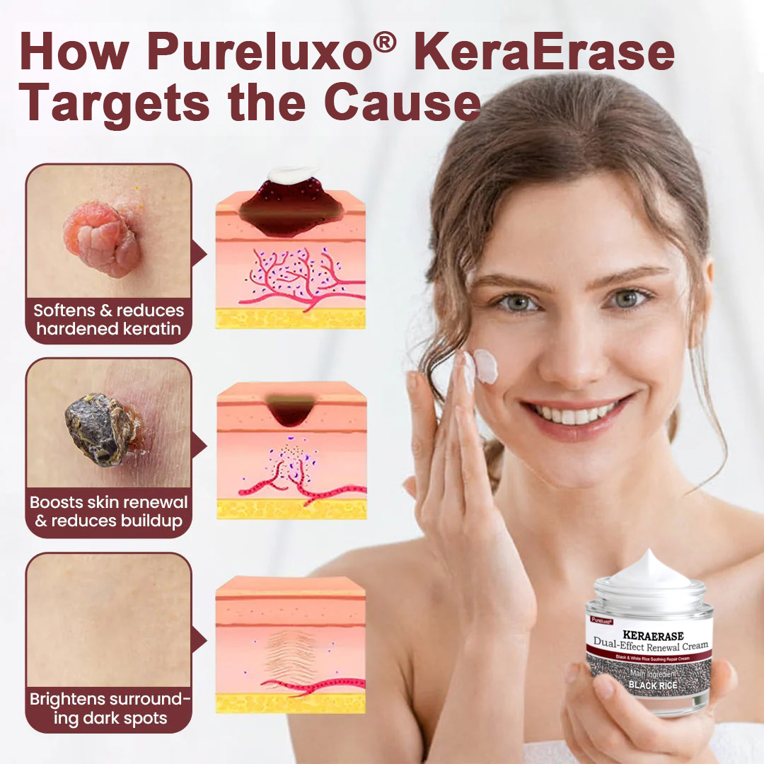 Pureluxo® KeraErase Dual-Effect Renewal Cream