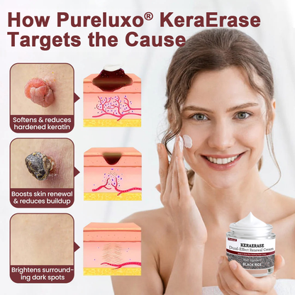 Pureluxo® KeraErase Dual-Effect Renewal Cream