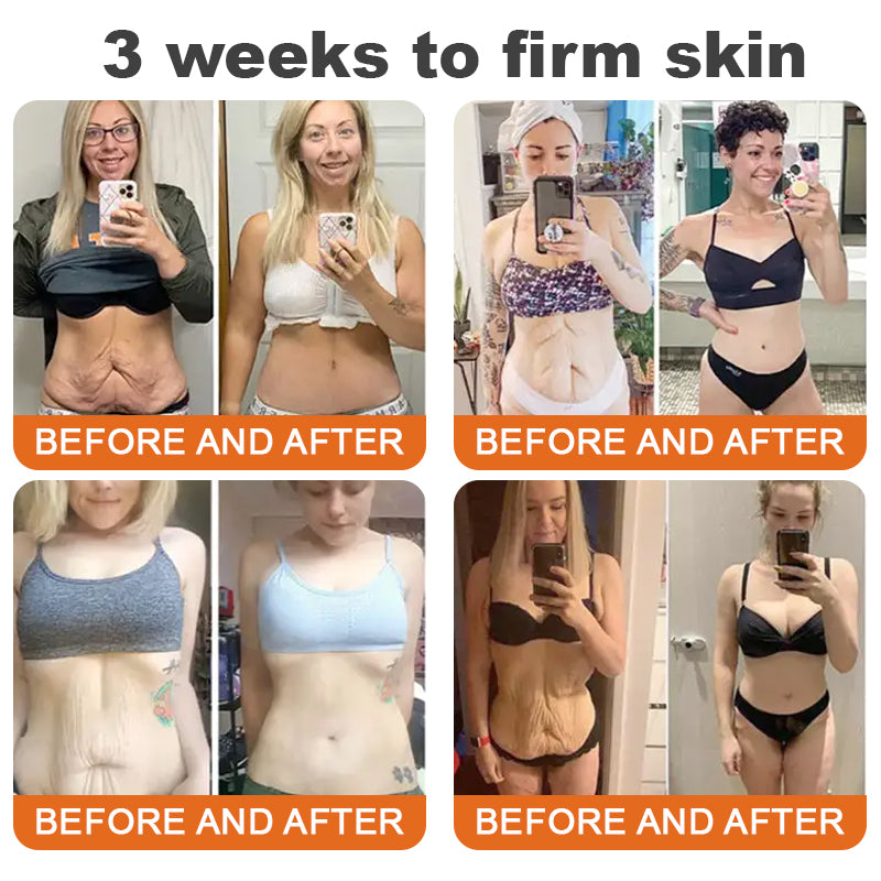 Made and Shipped from CAN✨TLOPA® Botox Bee Venom Firming Serum Stick✨(🔥LAST DAY 70% OFF🔥)