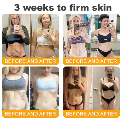 Made and Shipped from CAN ✨ Pureluxo® Bee Venom Skin Restoration Cream ⏰ LAST DAY 80% OFF