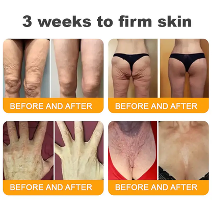 Made and Shipped from CAN ✨ Pureluxo® Bee Venom Skin Restoration Cream ⏰ LAST DAY 80% OFF