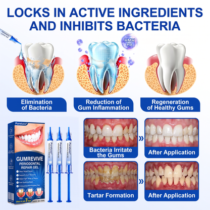 🇨🇦Pureluxo® 🦷GumRevive periodontal repair gel🌿