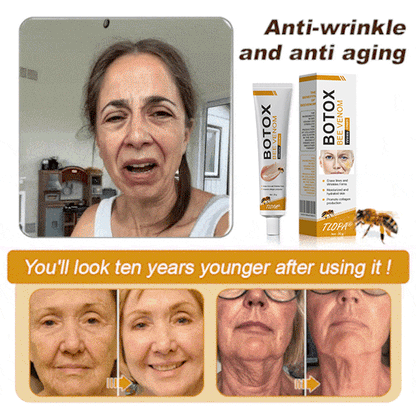(Made and Shipped from CAN) 🧑‍⚕️TLOPA® Botox Bee Venom Wrinkle Removal Cream- LAST DAY 70% OFF🔥