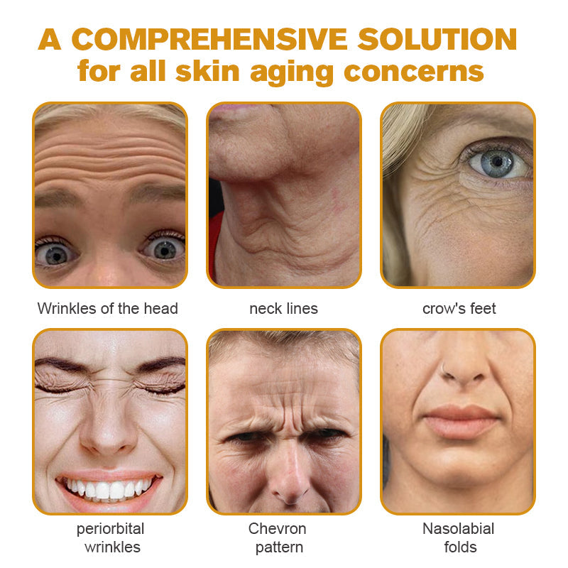 (Made and Shipped from CAN) 🧑‍⚕️TLOPA® Botox Bee Venom Wrinkle Removal Cream- LAST DAY 70% OFF🔥