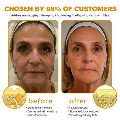 (Made and Shipped from CAN) 🧑‍⚕️TLOPA® Botox Bee Venom Wrinkle Removal Cream- LAST DAY 70% OFF🔥